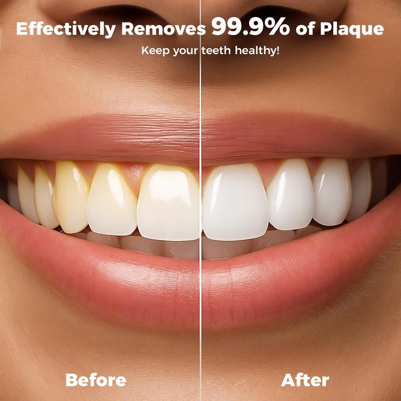 LINKEVAP Mini Water Flosser & Rechargeable Portable Oral Irrigator - Suitable for Travel and Business, Comes with 4 Nozzles & Detachable Water Tank